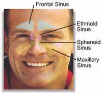 Click Here To See All Sinus Relief Products